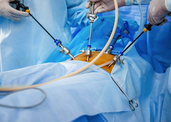 laparoscopy surgery laparoscopic 3d hospital nagar kamla
