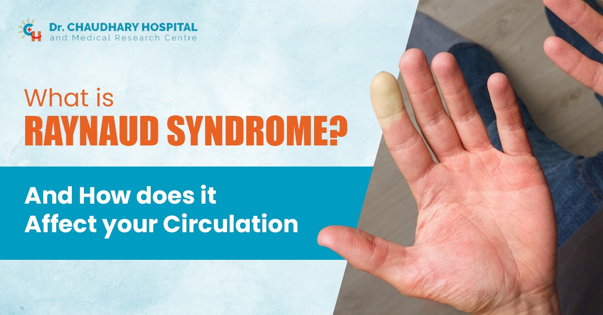 What is Raynaud Syndrome and How Does It Affect Your Circulation?